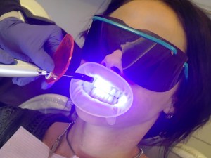 Insurance Dental Impant Medicare Supplements