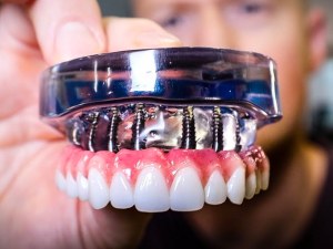 Dental Implants Near Me Low Costs