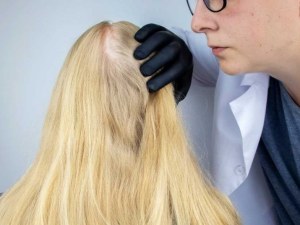 Meds Psoriasis Treatment